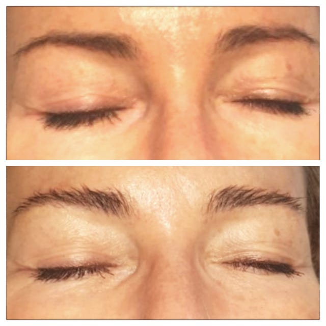 brow lamination
