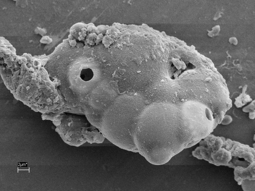 Tijdens de analyse werden microscopische zeedeeltjes gevonden zoals microalgen eerste foto en het eitje van een parasiet tweede foto