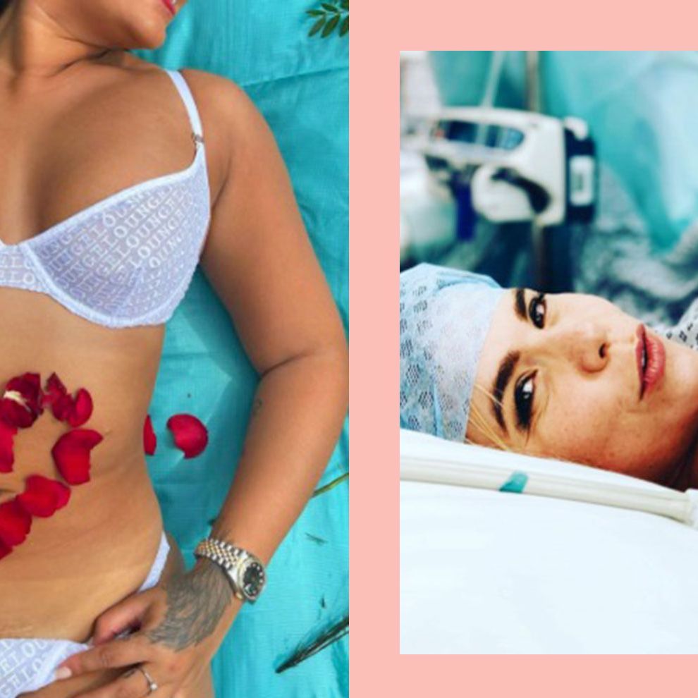 C-section scars: Celebs who have proudly shared their caesareans