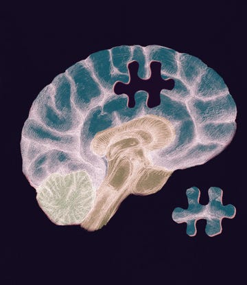 een brein met een missend puzzelstukje