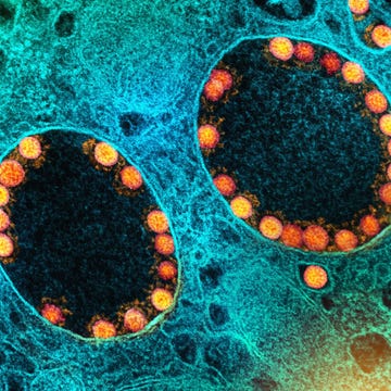 Gekleurde transmissie-elektronenmicroscoopopname gekleurde transmissieelektronenmicroscoopopname