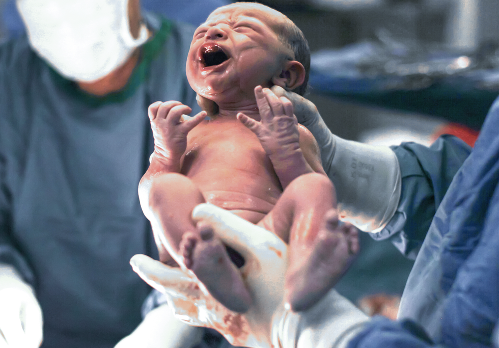 surgeon holds newborn baby