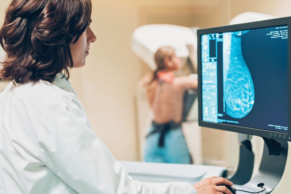 haciendo una mamografía cancer de mama