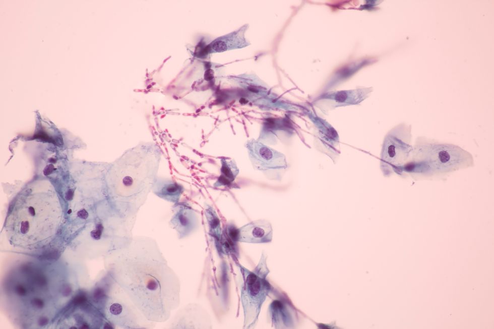 Candida view in microscopic - thrush