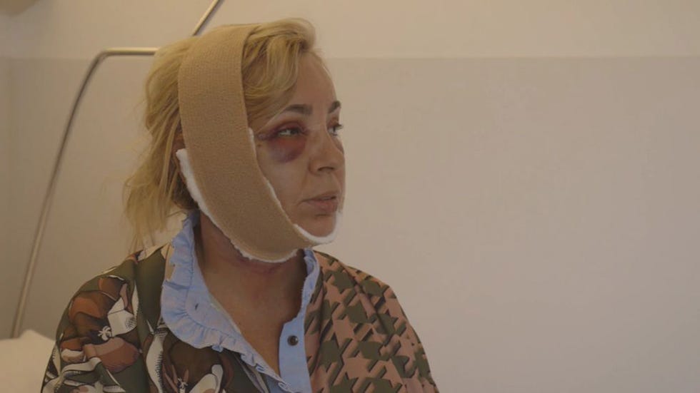 Carmen Borrego mostrará el resultado de su operación de papada en el último capítulo de 'Las Campos'.
