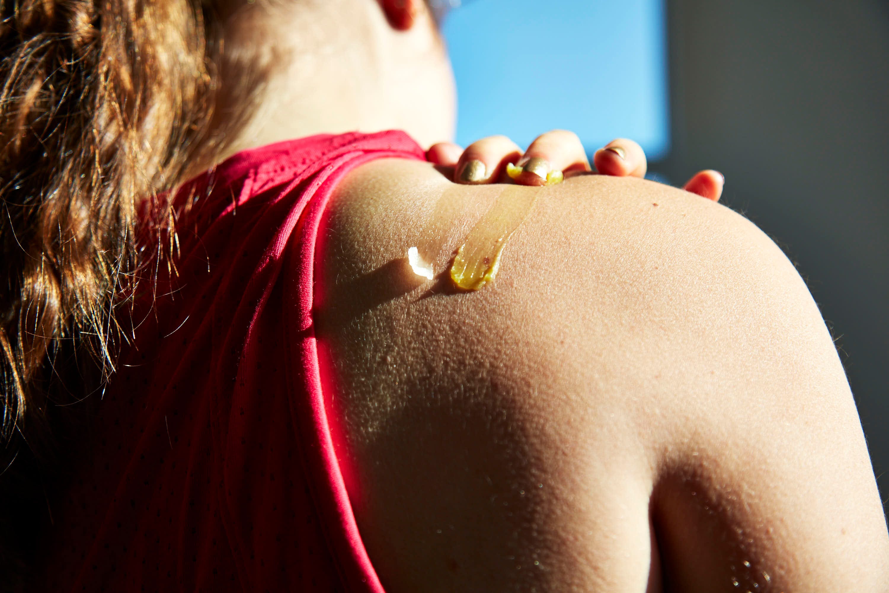 Shoulder, Red, Skin, Neck, Lip, Joint, Arm, Back, Pink, Blond, 