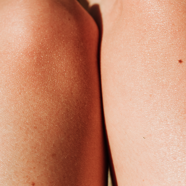 Let's talk about chafing