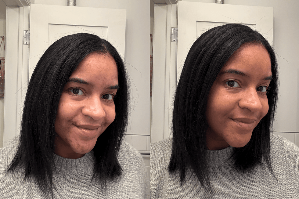 best foundations for acne — l'oreal paris Infallible Fresh Wear Foundation in a Powder l'oreal paris infallible fresh wear foundation in a powder