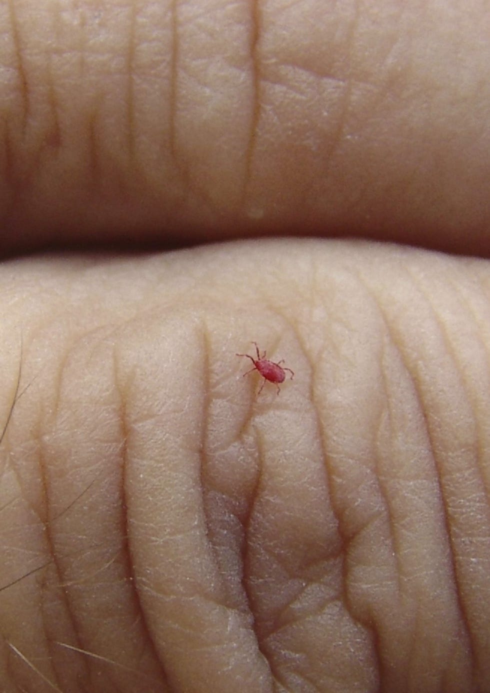 chigger