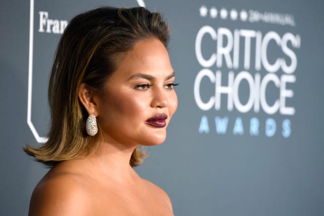Chrissy Teigen keeps it real by showing us her acne on Instagram