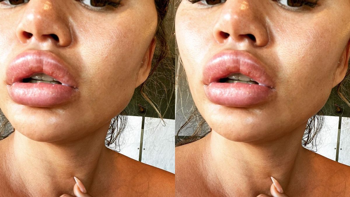preview for Chrissy Teigen's Road To Recovery Explained