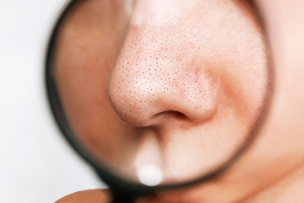 close up of a female nose with blackheads or black dots in a magnifying glass on a white background