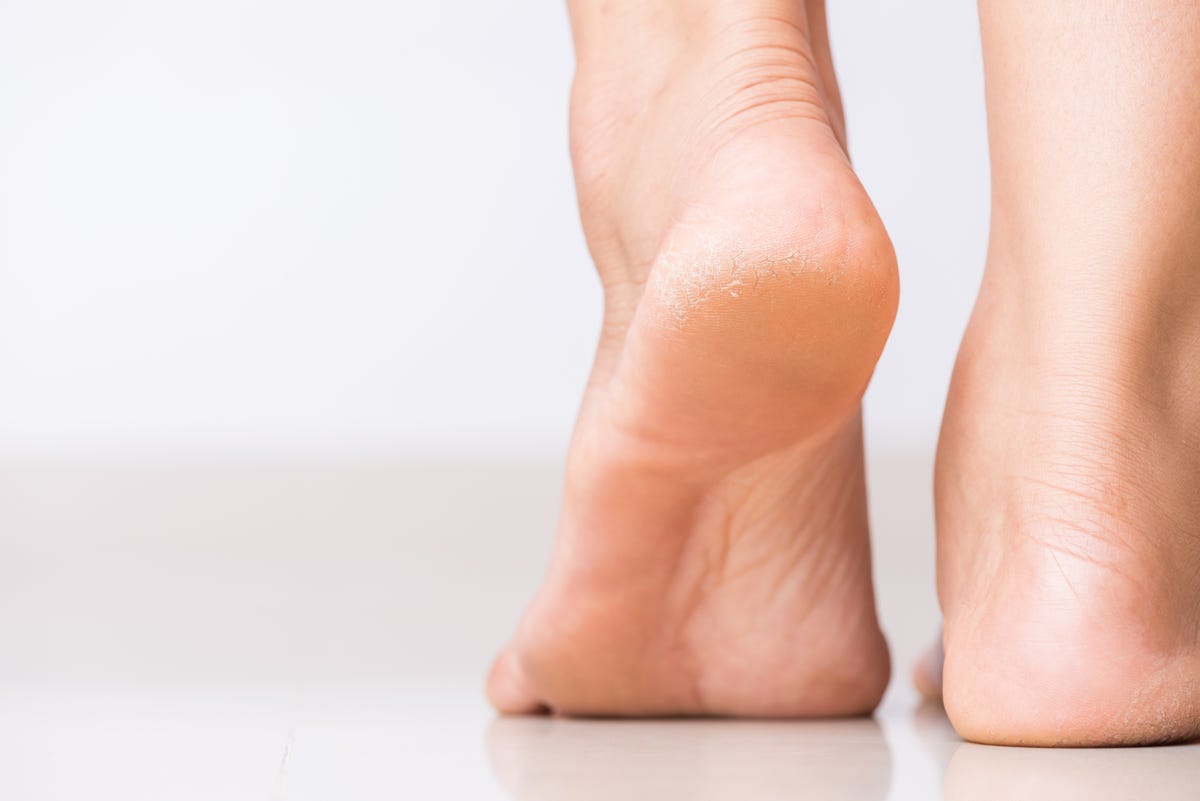 How to Remove Dead Skin from Feet: 7 Methods to Try