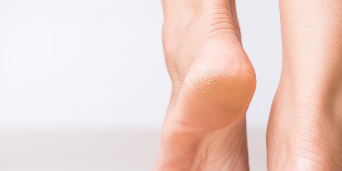 Heel Scraper Foot Scrubber Non-abrasive Foot Callus Remover For Soft Foot  Home & Outdoor Use