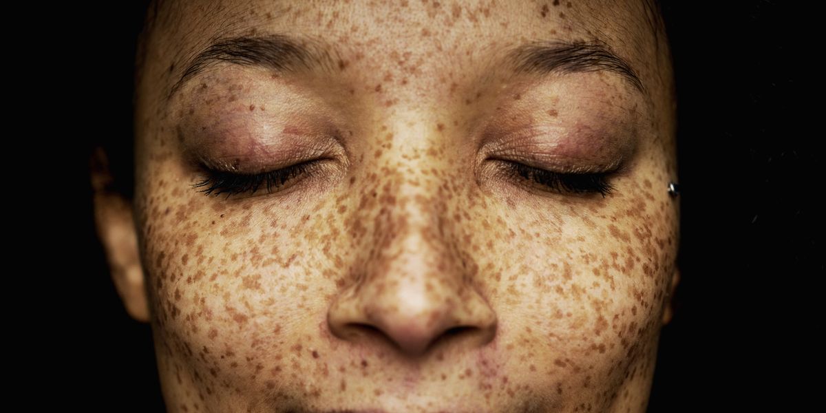 Does your skin really reflect your health?