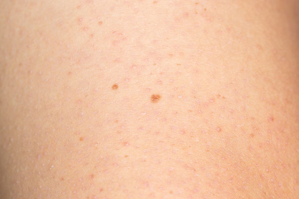 What Do Red Spots On Skin Mean 13 Skin Spots Bumps Pictures