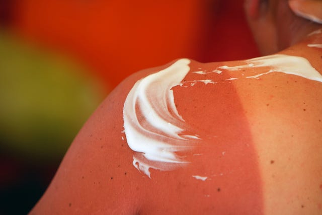 Sunscreen Mistakes 