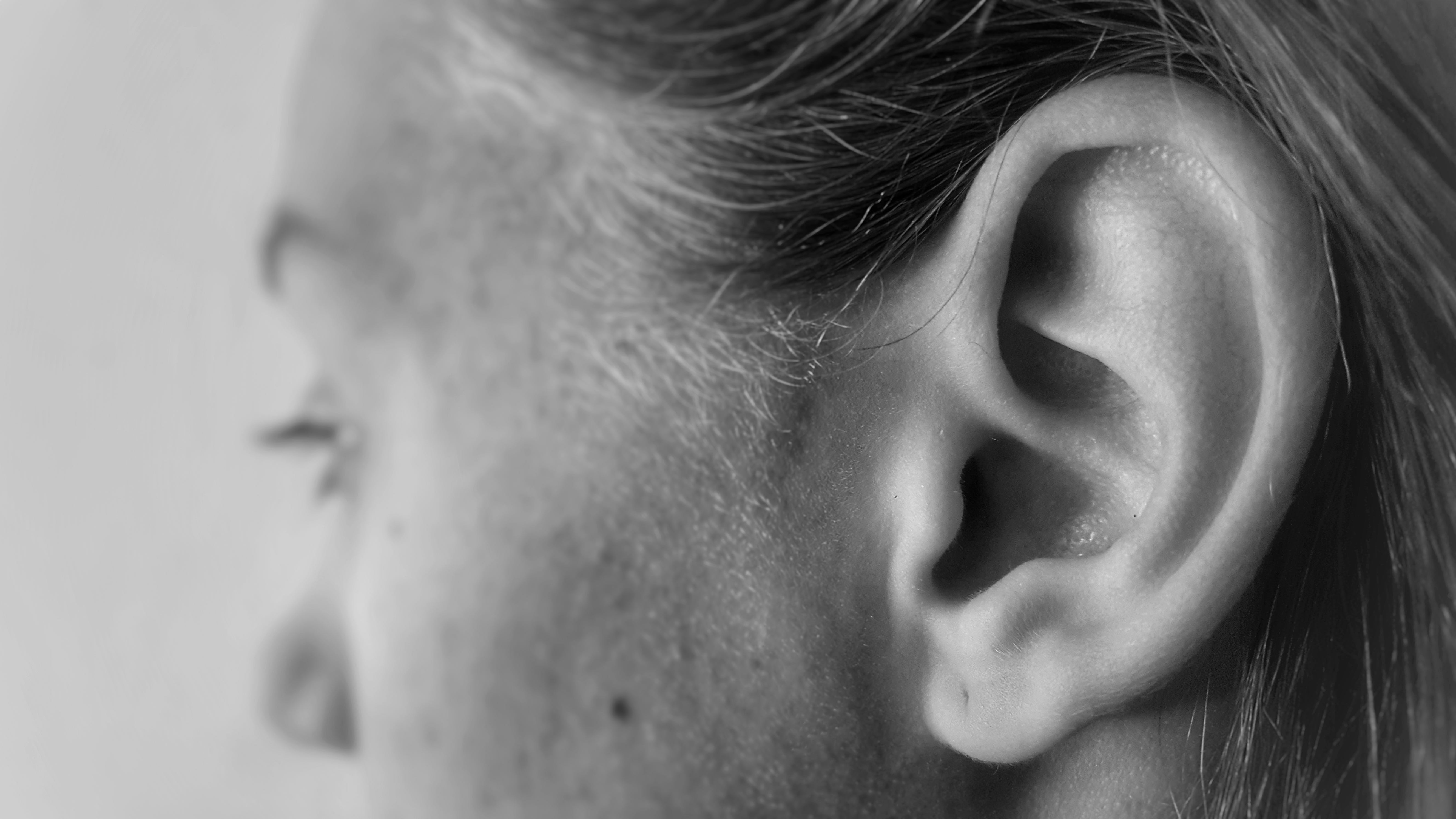 Big Blackheads Behind Ears - ji4u0nx