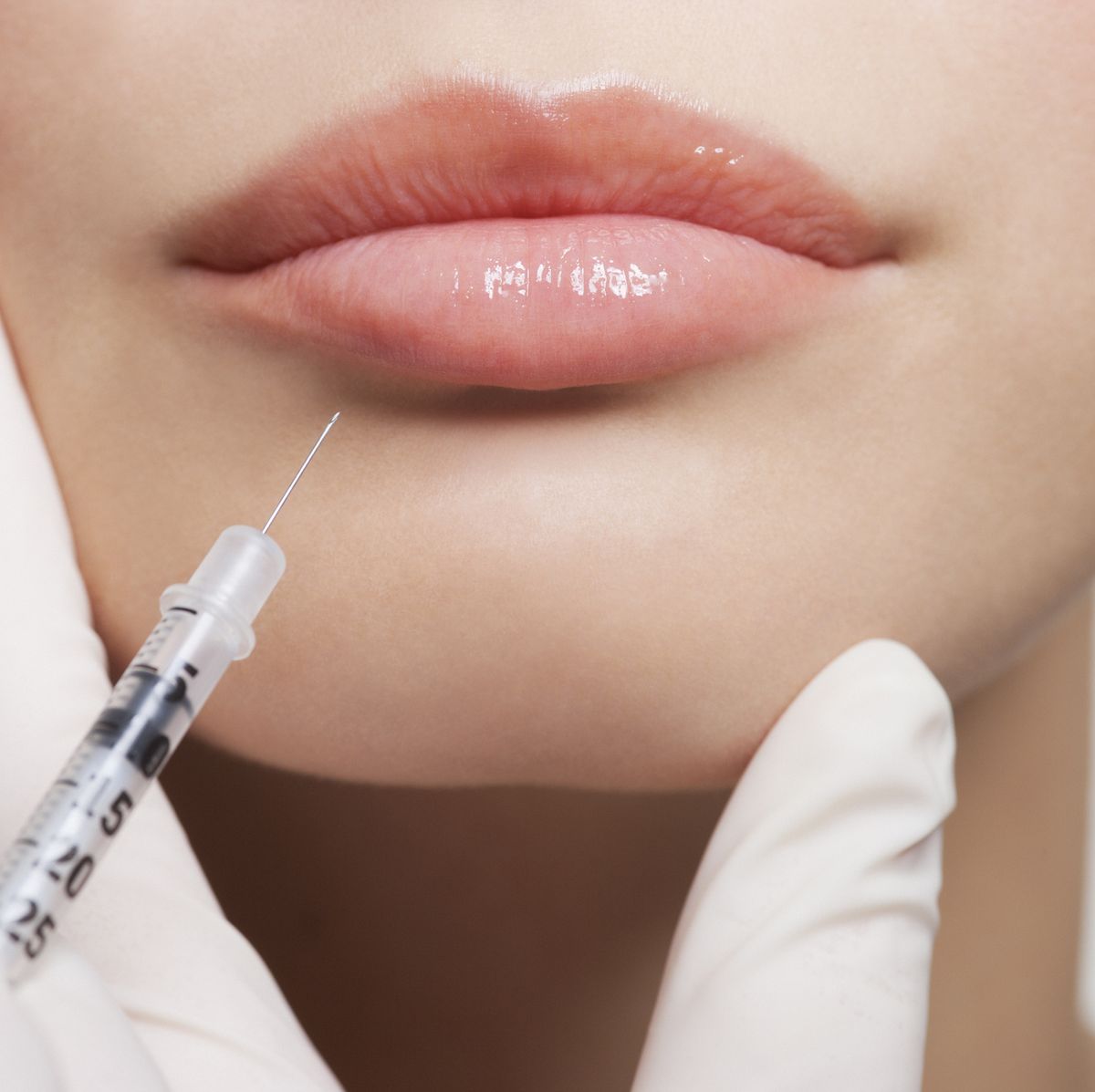 Want to know the cause of lip edema? ReSculpt Clinic can help you!