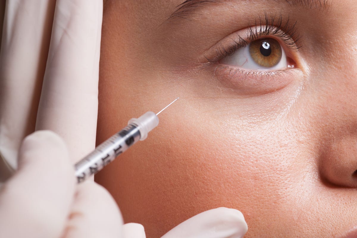 What Is Under-Eye Filler? Here's What You Need To Know