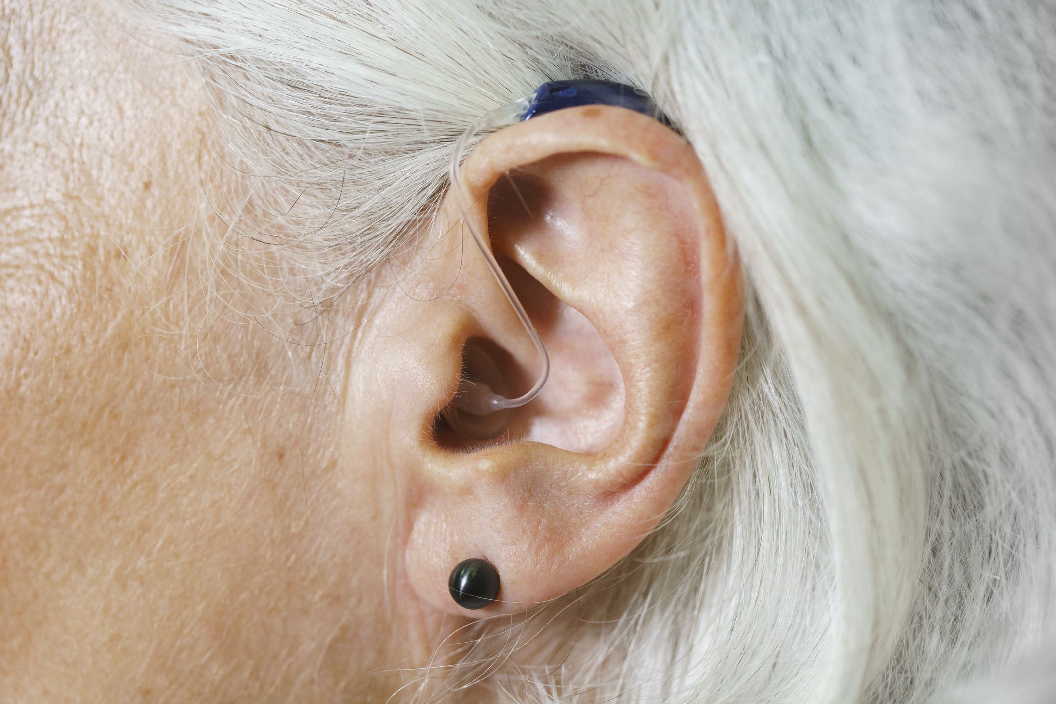 Dr. Pops Blackhead Pierced Through a Woman's Ear