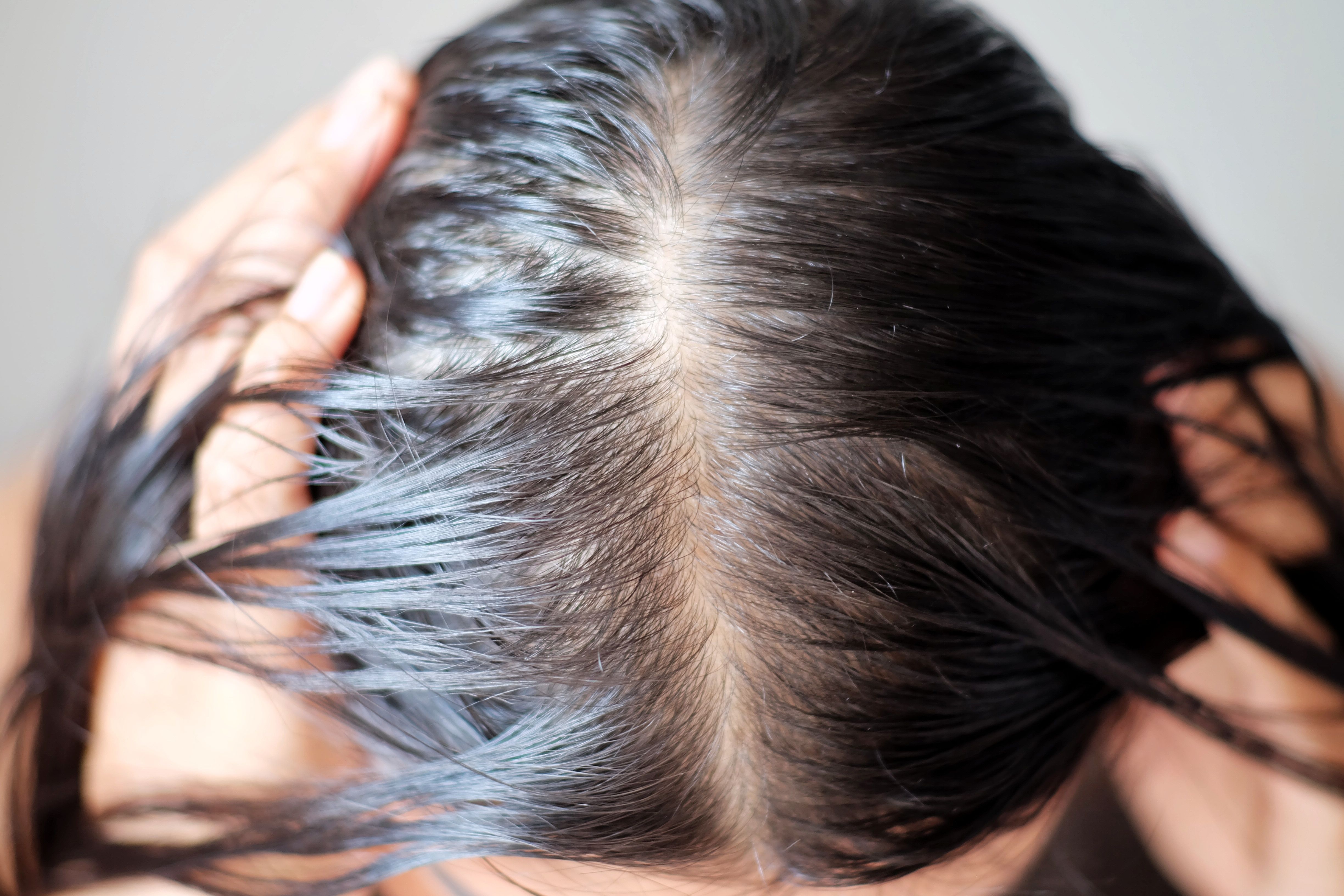 Hair dye can damage your skull  Graphic Online