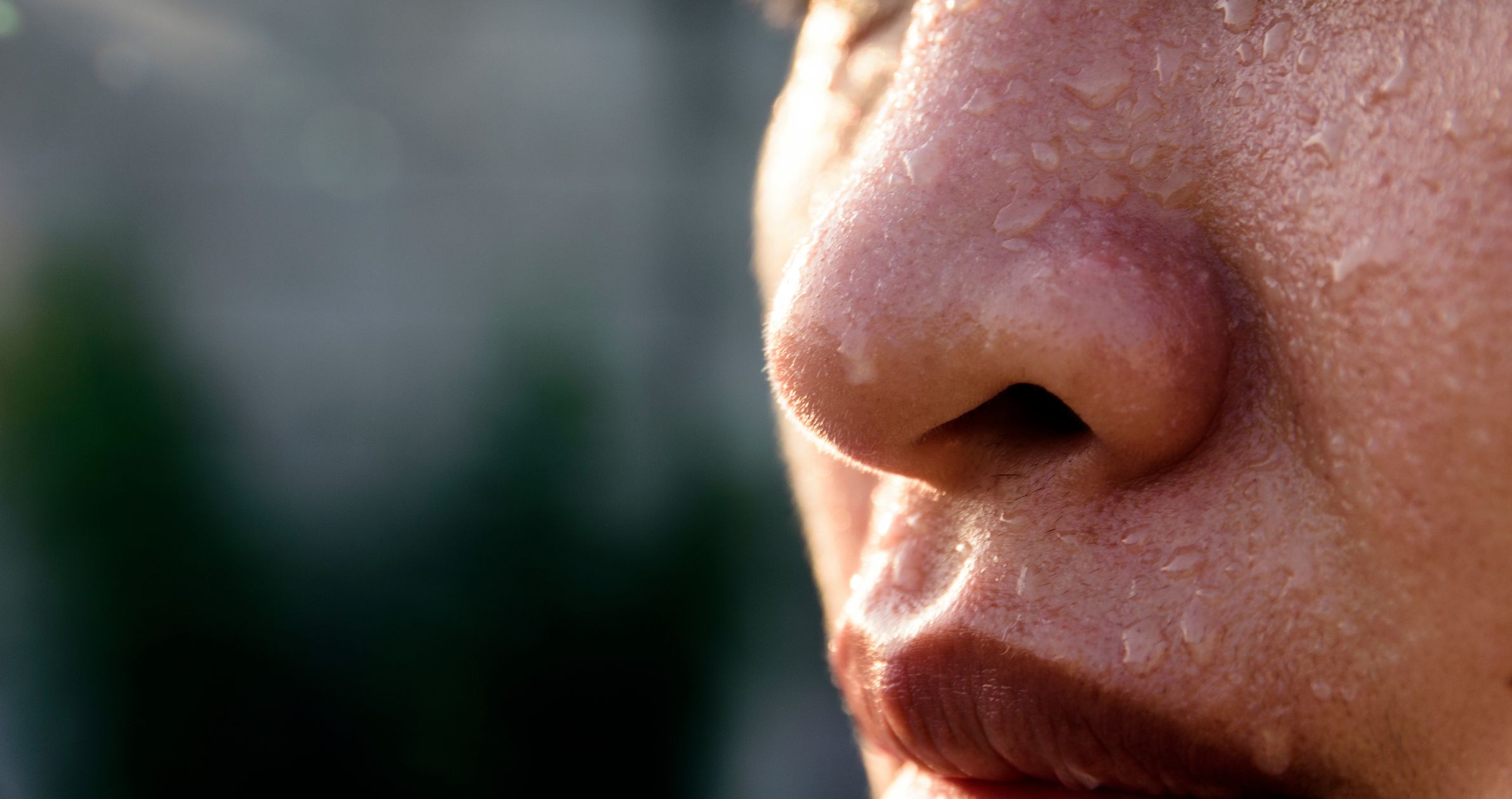 Dr. Pimple Popper Monster Milia On Woman's Nose On Instagram