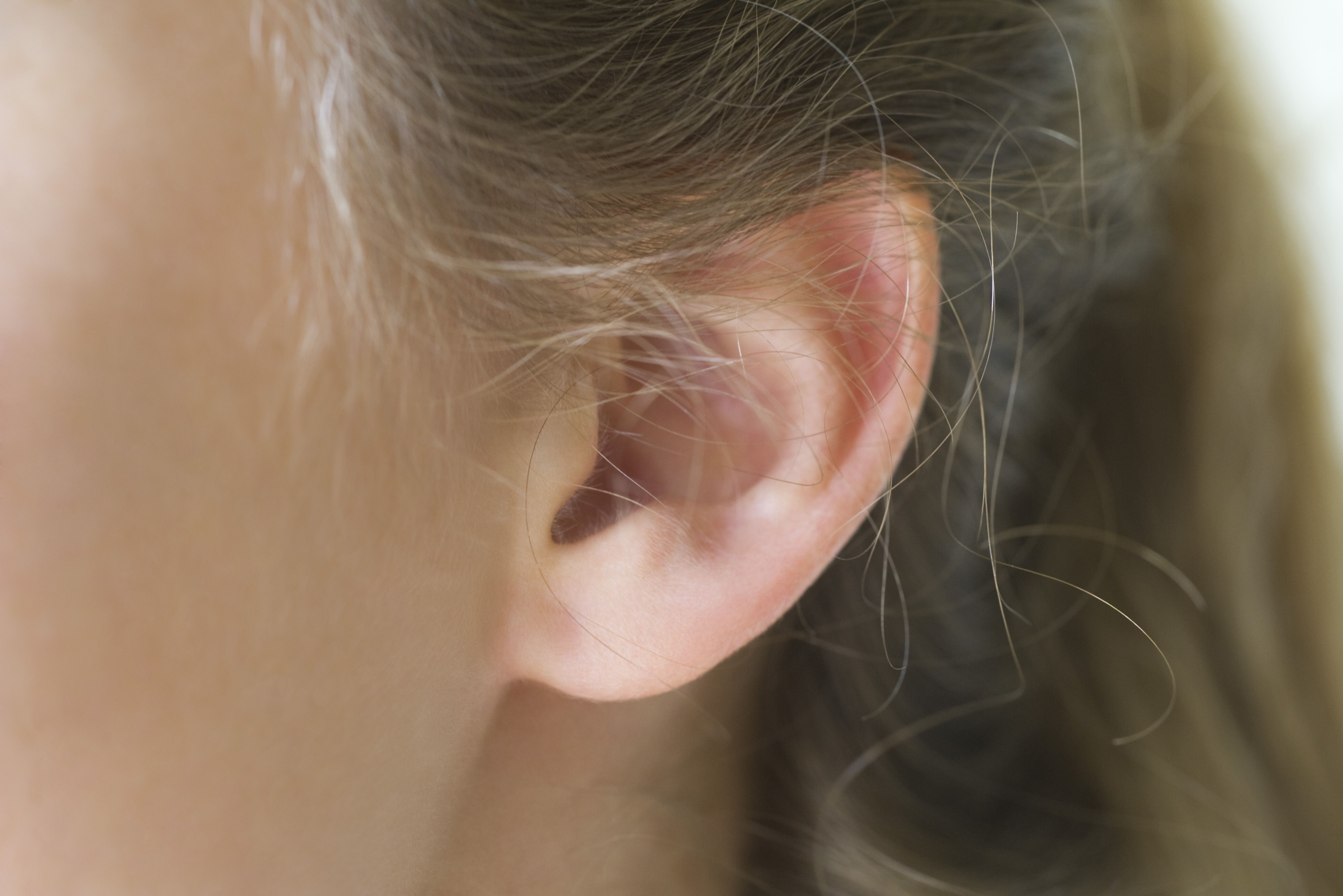 Big Blackheads Behind Ears