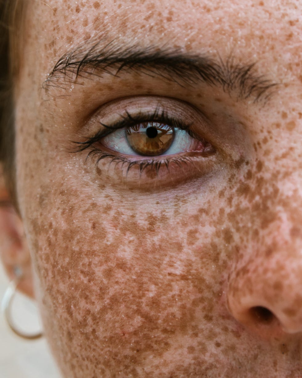 close up portrait of woman with freckles