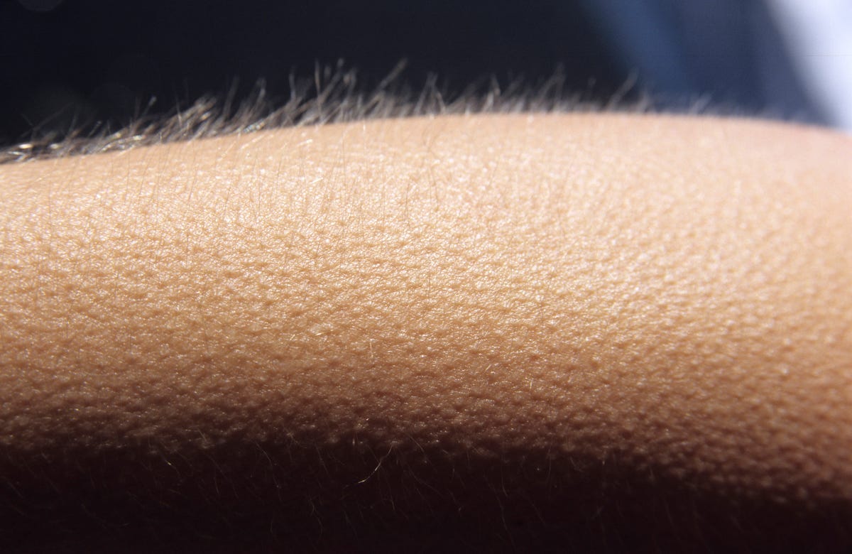 What Are Goosebumps? Why They Happen, According to Experts