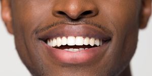 close up view of beaming orthodontic white wide male smile