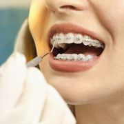 closeup dental braces checkup