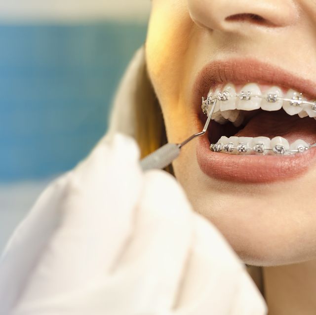 5 Surprising Benefits Of Straight Teeth - Dental Store