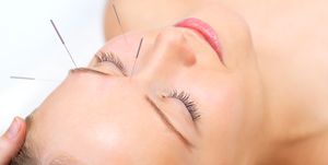 cosmetic acupuncture   facial acupuncture benefits
