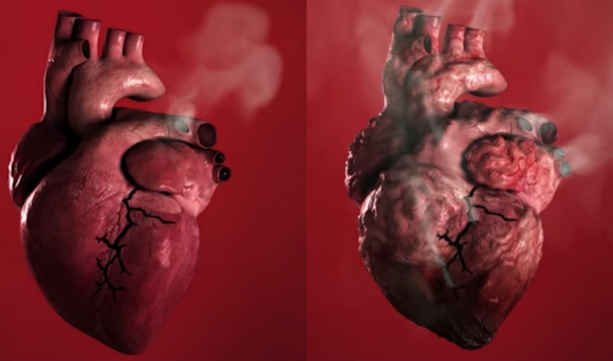 heart after smoking