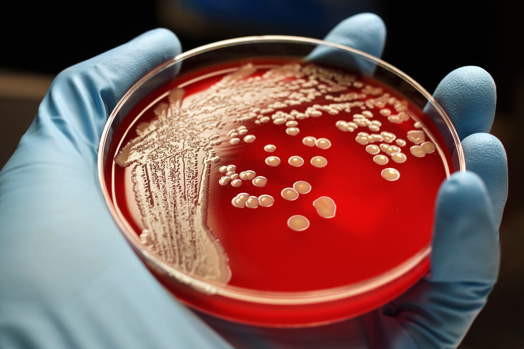 minor staphylococcus infection