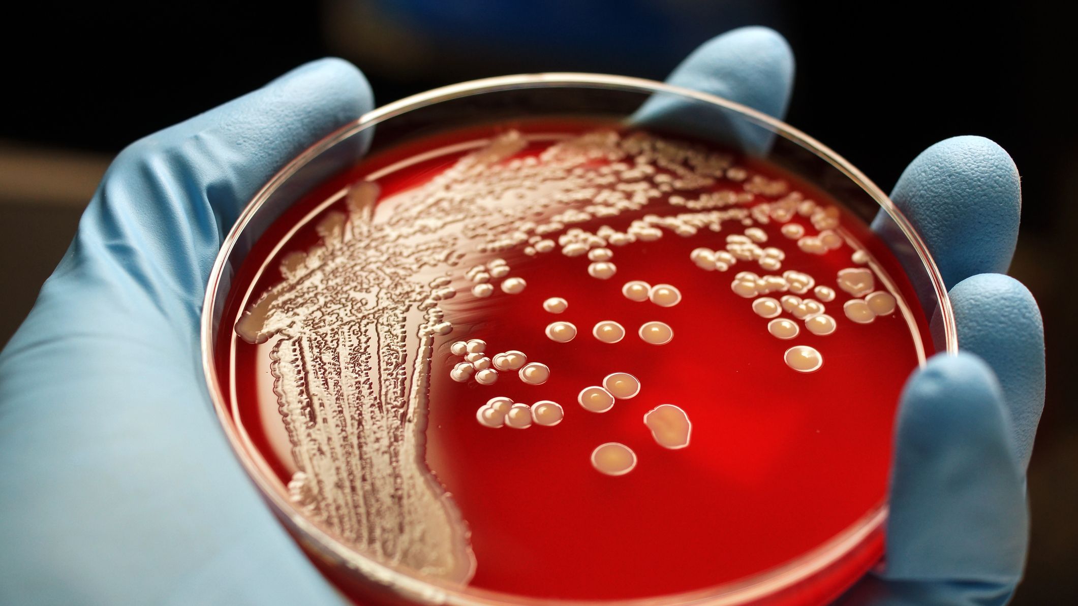 Premium Photo  Staphylococcus aureus antibiotic resistant bacteria