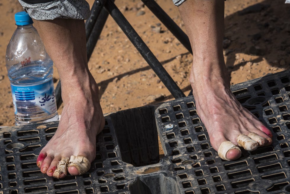 Dedos del Maratón des Sables