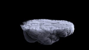 computed tomography of the brain and mri of the brain allows you to get a three dimensional image of various parts of the human brain, including the cerebral cortex, its internal and external parts