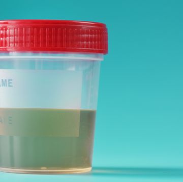 a container for biomaterials with a urine analysis and a red lid on a cyanic background