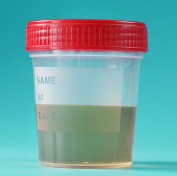 a container for biomaterials with a urine analysis and a red lid on a cyanic background
