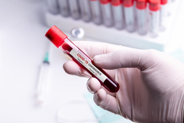 How Blood Type Impacts COVID-19 Risk, According to Doctors