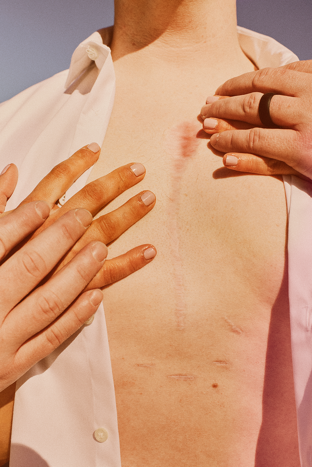 woman touching mans chest with scar