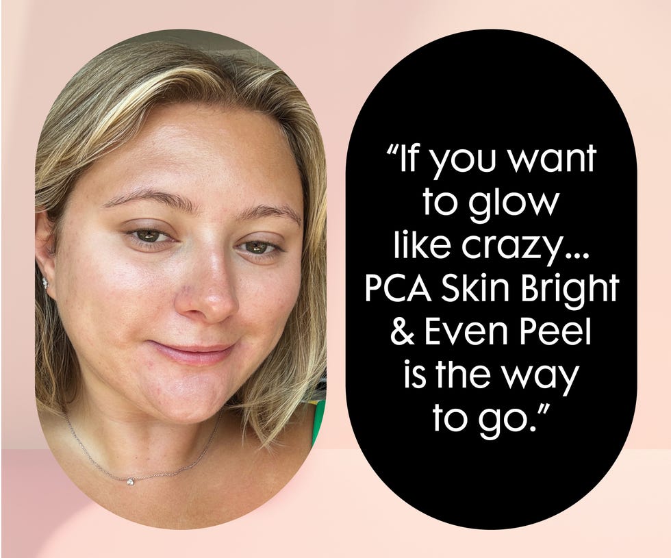 pca skin light even peeling