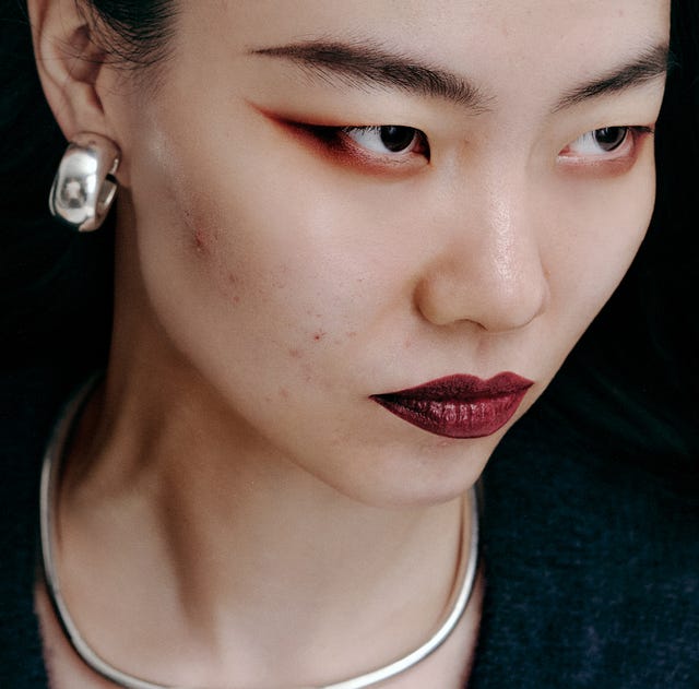 acne acne