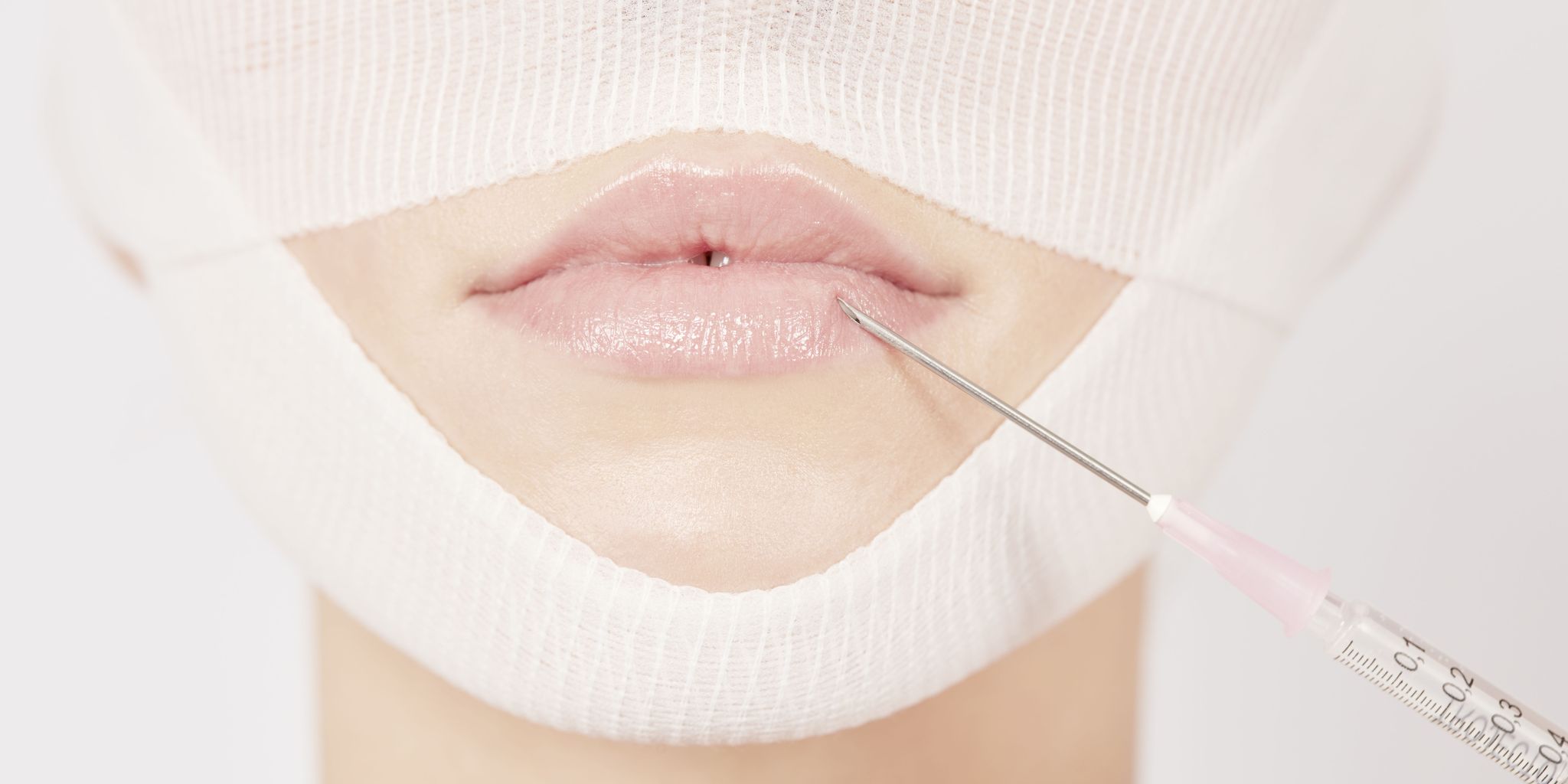 Syringe injecting botox into womans lips.