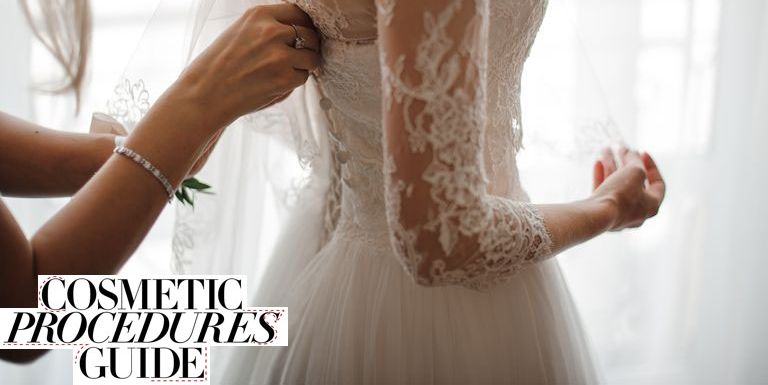 With bridal cosmetic surgery on the rise, here's what you need to know