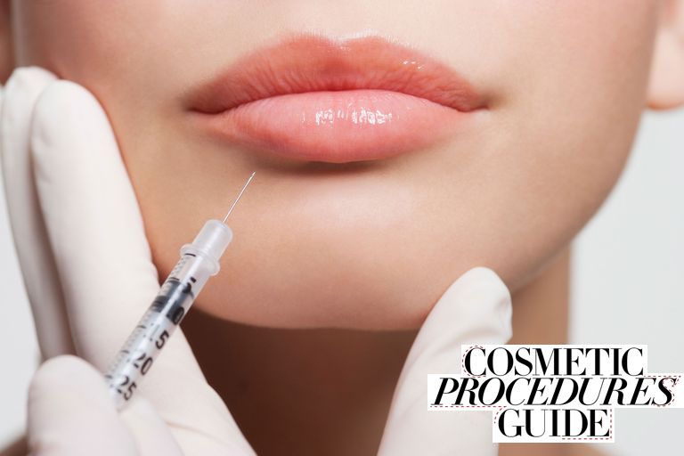 Cosmetic procedures guide – Lip fillers