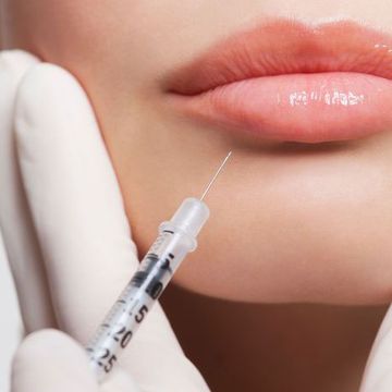 Cosmetic procedures guide – lip fillers