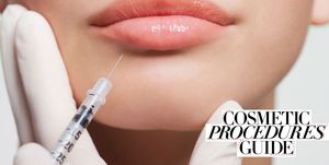 Cosmetic procedures guide – lip fillers